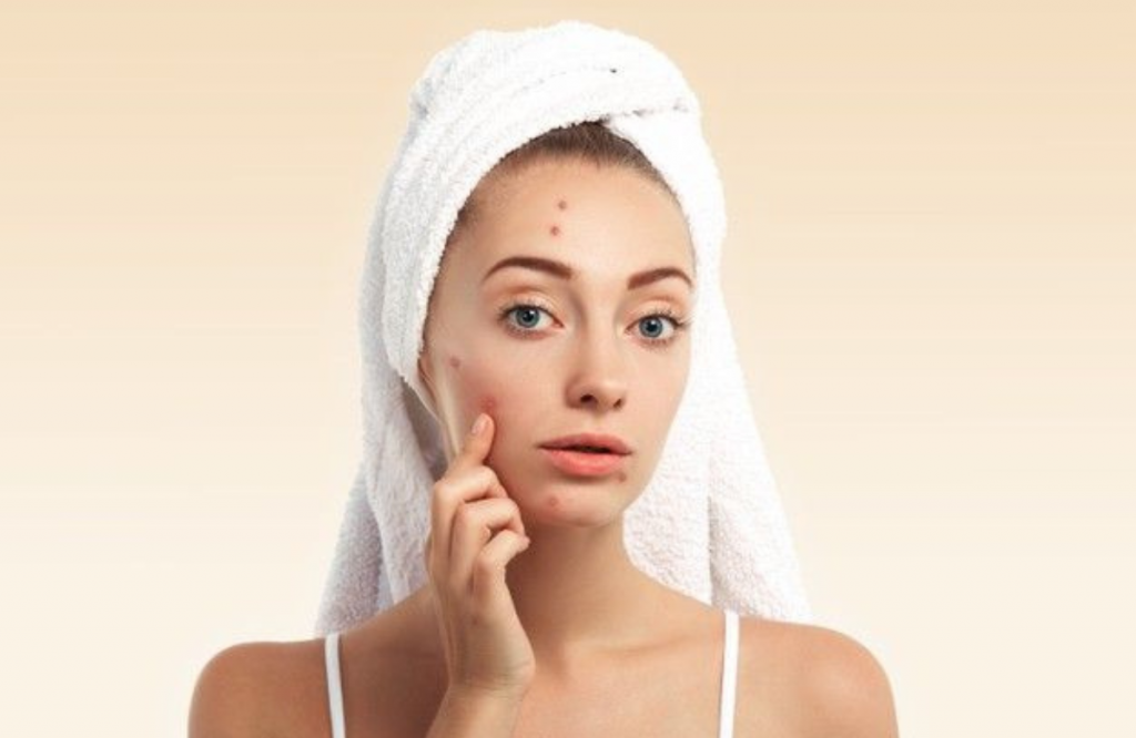 Best makeup for acne prone skin 